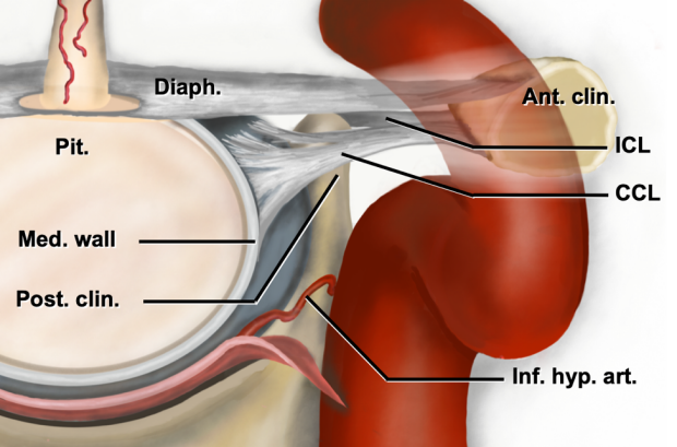 an illustration of the selective resection