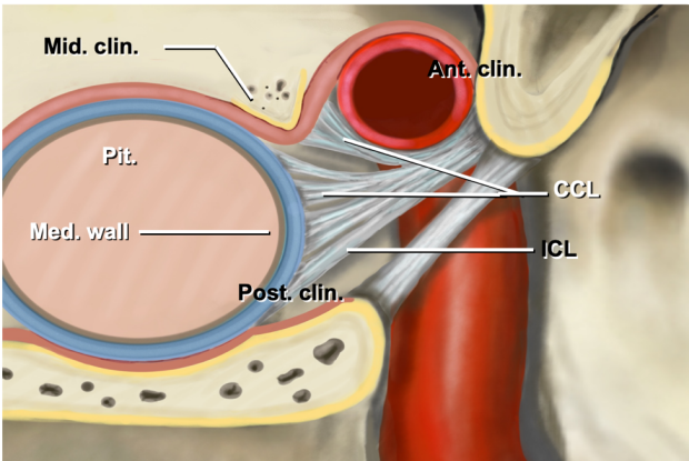 an illustration of selective resection