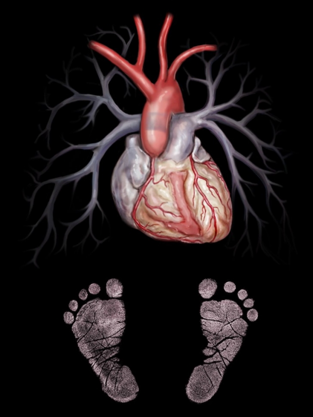 medical illustration of pediatric heart and lungs