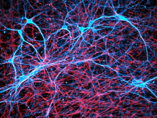   Neurons (blue) play a surprising part in how some cancers take root in the brain.Credit: Daniel Schroen/Cell Applications INC/Science Photo Library