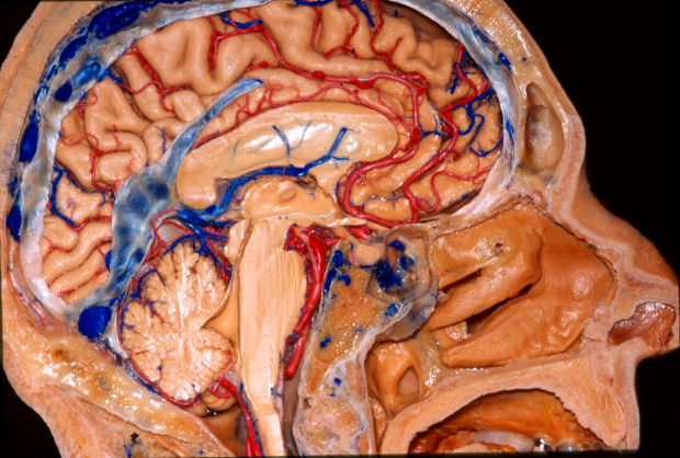 neuroanatomy fiber tractography stanford