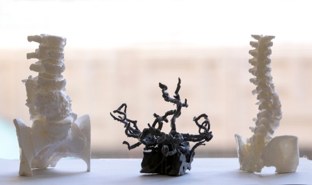 3-D print models of spine and neural networks