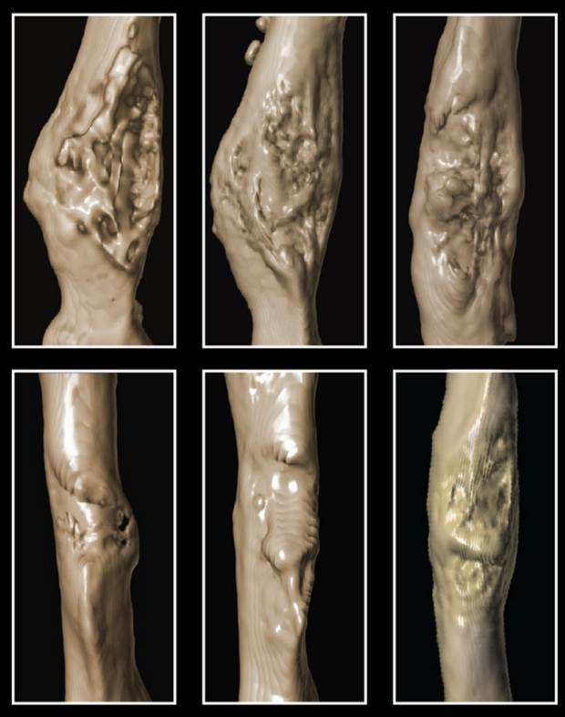 Six separate images of damaged bones