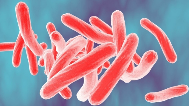 Test could help prevent TB deaths