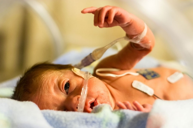 Premature infant with a tube in its nose