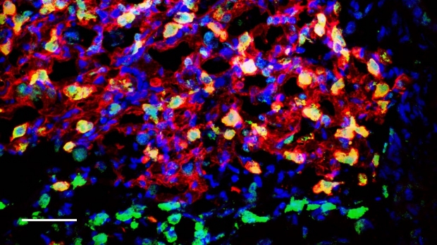 Researchers discover lung stem cell in mice
