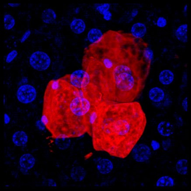 Image of liver cells