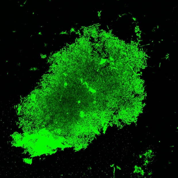 Fluorescent image of tuberculosis bacteria