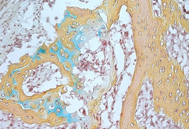 Image of a skeletal stem cell