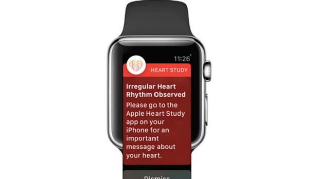 Stanford, Apple describe heart study with over 400,000 participants
