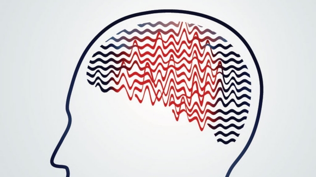 Epilepsy-associated cognitive disruption 