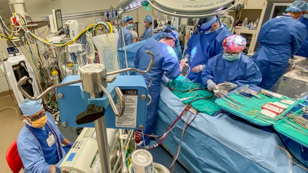 Stanford marks 1,000th heart-lung and lung transplant