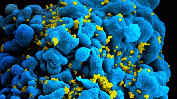 HIV vaccine proves effective in primates