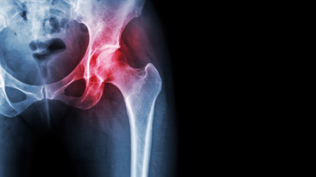 Researchers find method to regrow cartilage in the joints