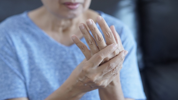 Osteoarthritis linked to allergic inflammation