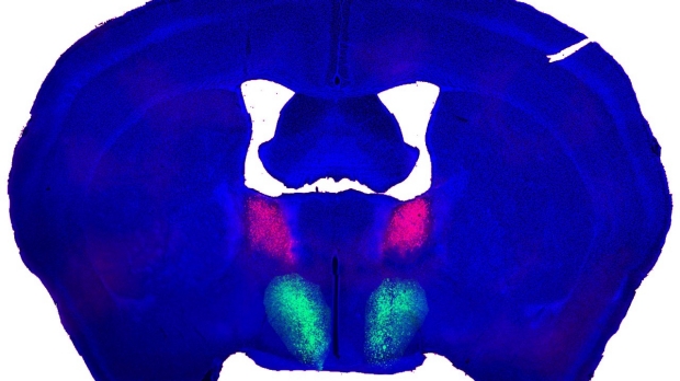 Stanford Medicine scientists locate key brain circuit containing the seat of male libido