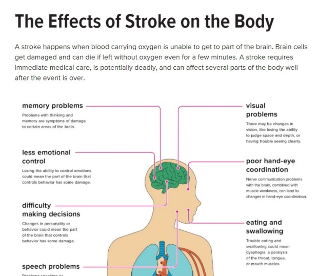 Effects of Stroke on the Body